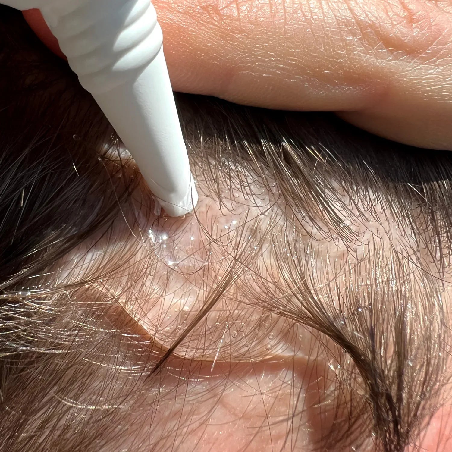 Hair Growth Activator | Shavy™