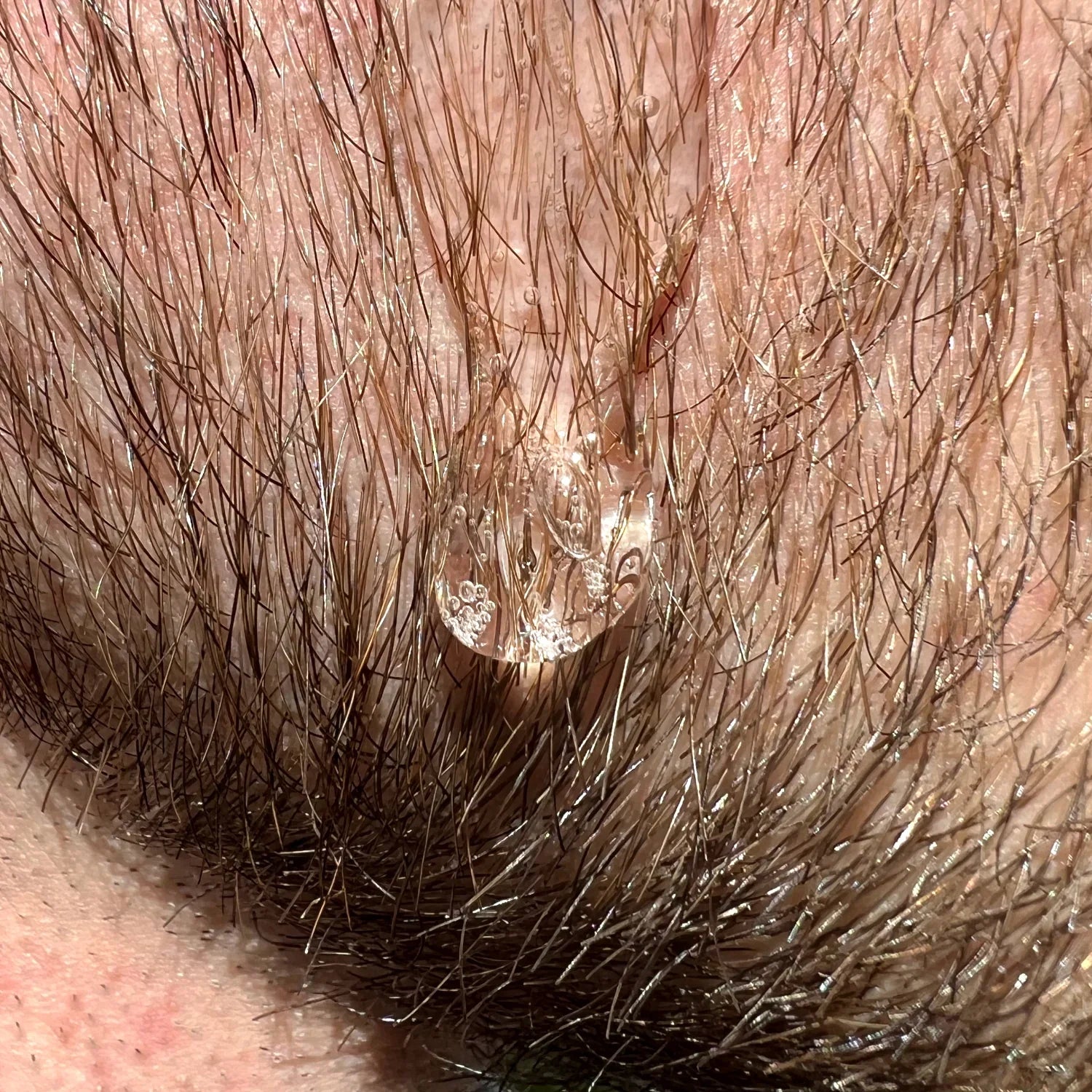 Beard Growth Stimulator | Shavy™